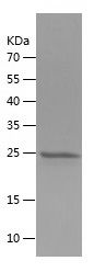    FGF9 / Recombinant Human FGF9