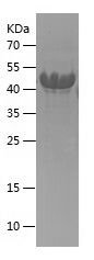    CDKN1C / Recombinant Human CDKN1C