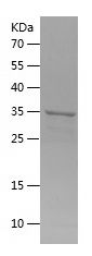    ANTXR1 / Recombinant Human ANTXR1