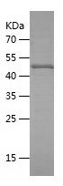    PDCD6IP / Recombinant Human PDCD6IP