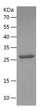    AQP1 / Recombinant Human AQP1