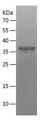    CD8A / Recombinant Human CD8A