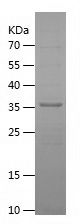    MPPED2 / Recombinant Human MPPED2