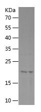    FGF12 / Recombinant Human FGF12