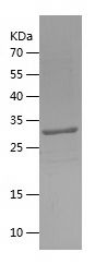    RIOX1 / Recombinant Human RIOX1