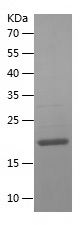    NHP2 / Recombinant Human NHP2