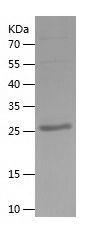    Gankyrin / Recombinant Human Gankyrin