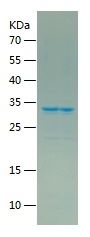    PAK4 / Recombinant Human PAK4