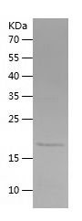    ONECUT2 / Recombinant Human ONECUT2