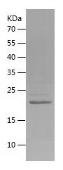    ARF5 / Recombinant Human ARF5