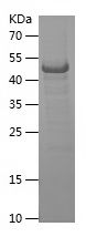    CD49d / Recombinant Human CD49d