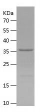    KLRG1 / Recombinant Human KLRG1