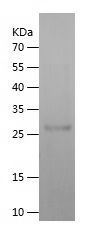    TSHR / Recombinant Human TSHR