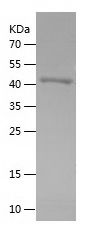    OSGIN1 / Recombinant Human OSGIN1