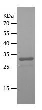    LH2 / Recombinant Human LH2