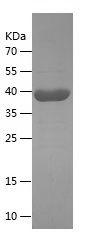    ANXA6 / Recombinant Human ANXA6