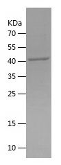    MBIP / Recombinant Human MBIP