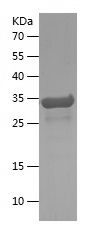    PTBP1 / Recombinant Human PTBP1