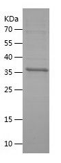    PTPRS / Recombinant Human PTPRS