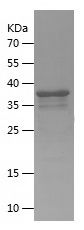    PLEKHF1 / Recombinant Human PLEKHF1