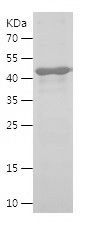    LTBP1 / Recombinant Human LTBP1