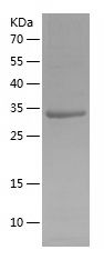    MS4A12 / Recombinant Human MS4A12