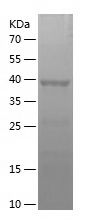    MAT1A / Recombinant Human MAT1A