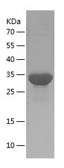    S100A9 / Recombinant Human S100A9