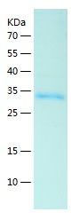    HP / Recombinant Human HP