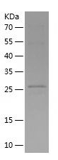    CD80 / Recombinant Human CD80