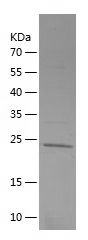    ULK1 / Recombinant Human ULK1