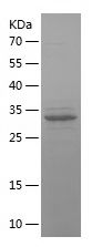    BCL9 / Recombinant Human BCL9