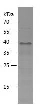    TSSC4 / Recombinant Human TSSC4