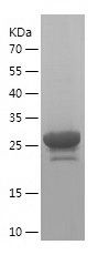    AIF1 / Recombinant Human AIF1