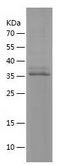    PNCK / Recombinant Human PNCK