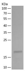    CTBP2 / Recombinant Human CTBP2