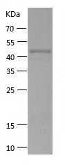    PARP9 / Recombinant Human PARP9