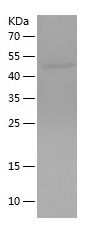    IL-36R / Recombinant Human IL-36R