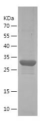    VIL1 / Recombinant Human VIL1