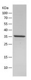    NF1 / Recombinant Human NF1