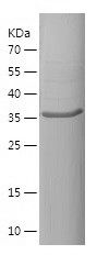    Thyroglobulin / Recombinant Human Thyroglobulin