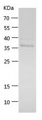    SLC45A3 / Recombinant Human SLC45A3