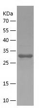    CD59 / Recombinant Human CD59