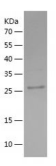    TIRAP / Recombinant Human TIRAP