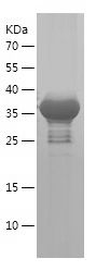    MIRO2 / Recombinant Human MIRO2