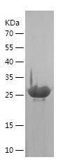 Recombinant Rat copeptin