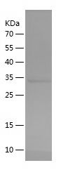    TTF1 / Recombinant Human TTF1