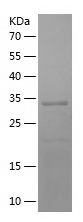    WT1 / Recombinant Human WT1