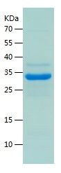    ProGRP / Recombinant Human ProGRP