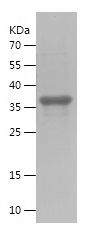    IL23A / Recombinant Human IL23A